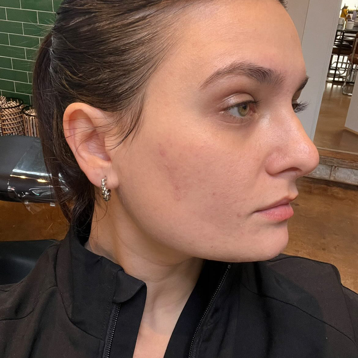 Before & After Results