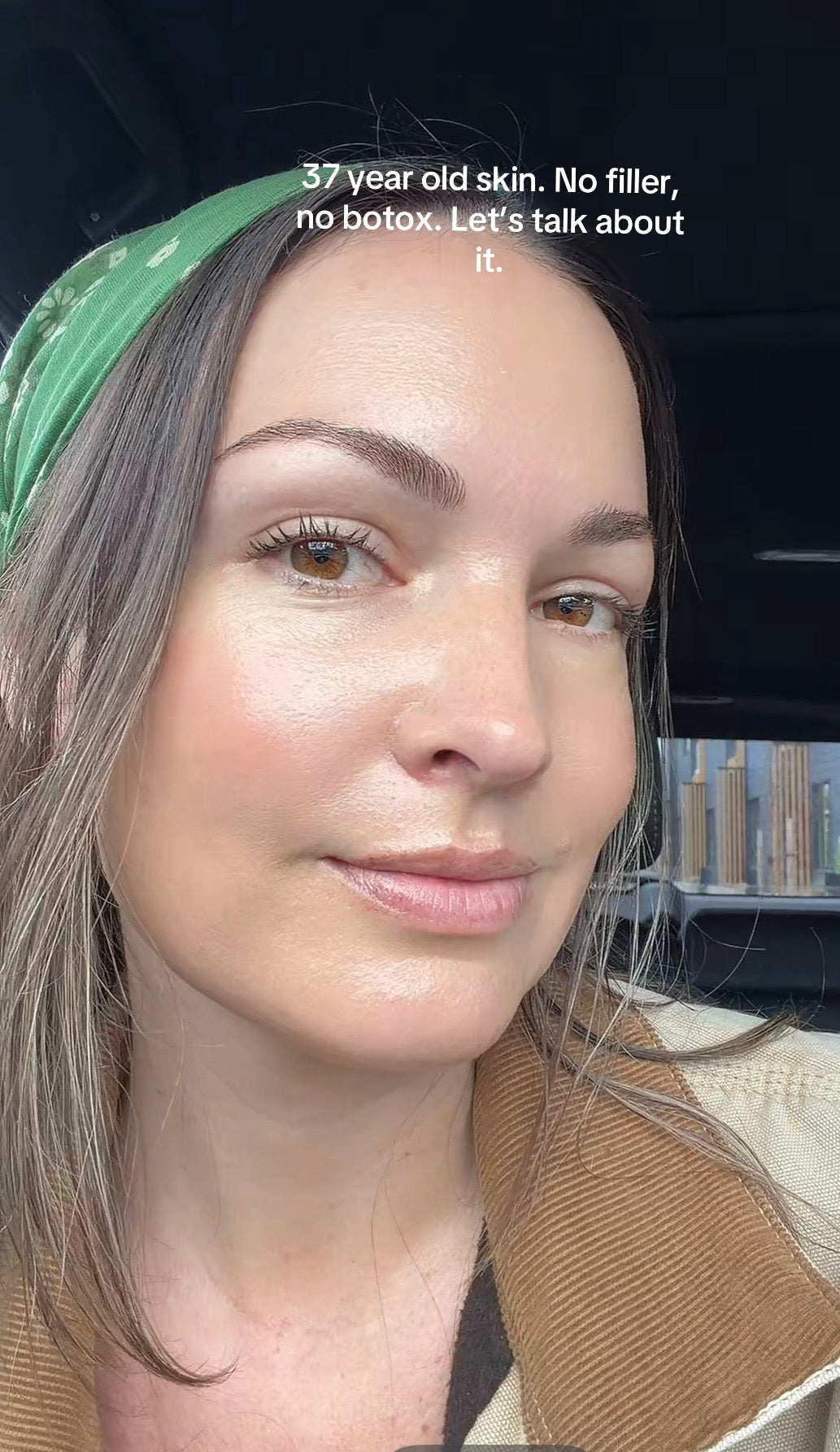 Alternative Options To Botox & Fillers