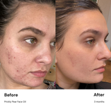 Prickly Pear Face Oil - Imperfect Packaging